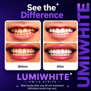 LumiWhite® Smile Strips